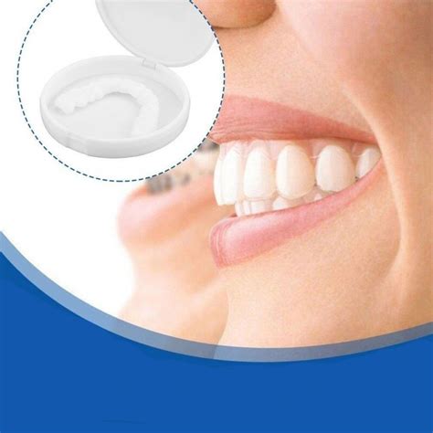 Achieve Straight Teeth without Orthodontic Treatment: The Magic Teeth Brace Perfect Smile Veneers Solution